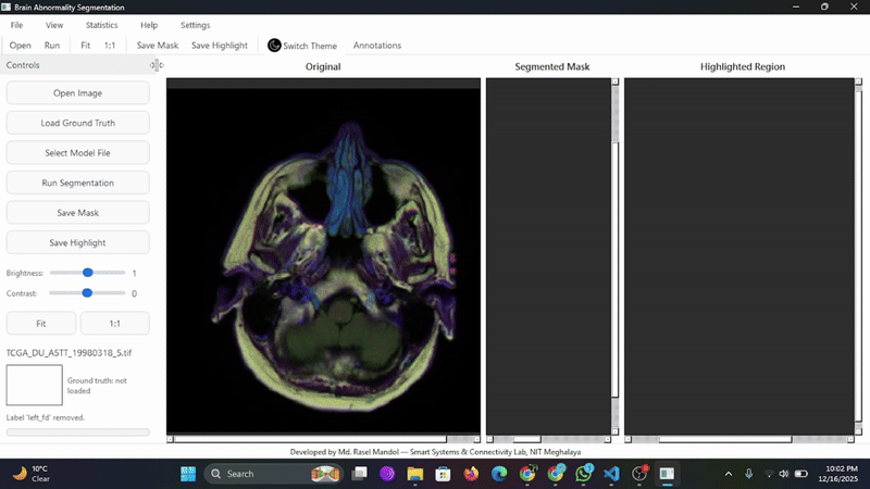 BrainSeg segmentation demo