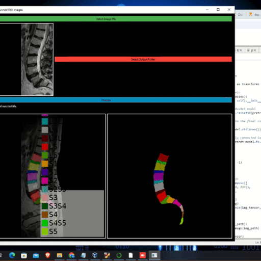 MRI-SEG Lite spine segmentation gif
